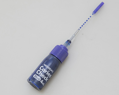 茗荷谷駅徒歩2分の歯医者｜佐藤歯科医院のむし歯治療