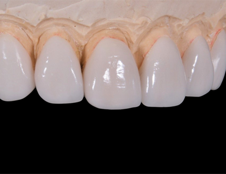 茗荷谷駅徒歩2分の歯医者｜佐藤歯科医院の審美歯科