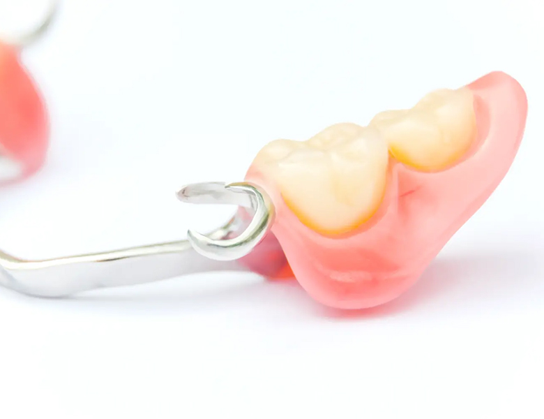 茗荷谷駅徒歩2分の歯医者｜佐藤歯科医院のインプラント治療