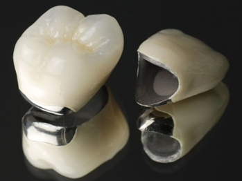 茗荷谷駅徒歩2分の歯医者｜佐藤歯科医院の審美歯科