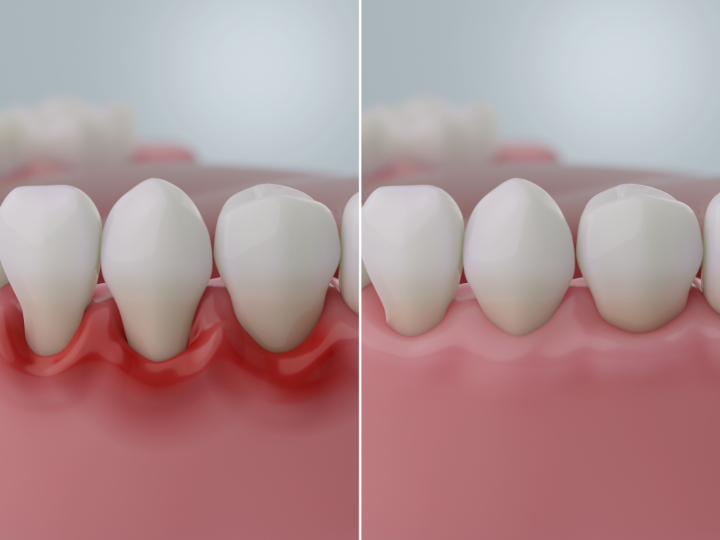 茗荷谷駅徒歩2分の歯医者｜佐藤歯科医院の審美歯科