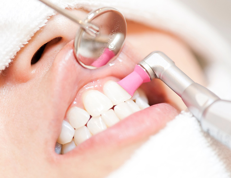 茗荷谷駅徒歩2分の歯医者｜佐藤歯科医院の予防歯科