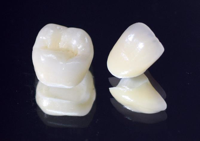 茗荷谷駅徒歩2分の歯医者｜佐藤歯科医院の審美歯科